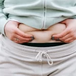 abdominoplastia